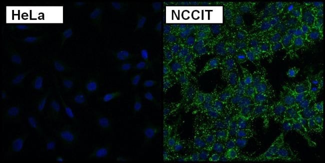 SSEA3 Monoclonal Antibody (MC-631)