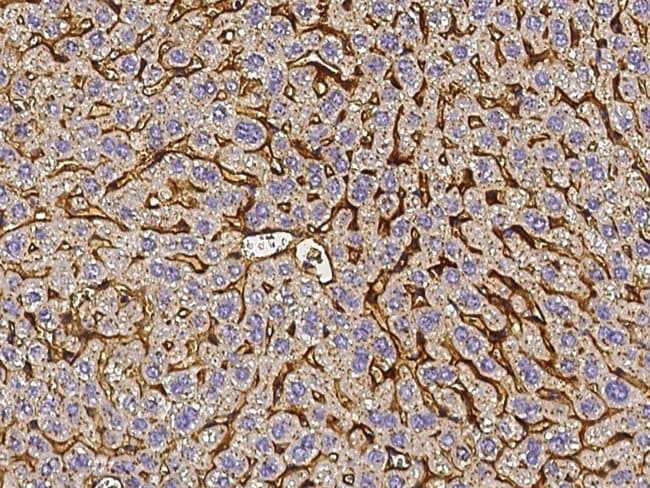 Vitronectin Recombinant Rabbit Monoclonal Antibody (019)