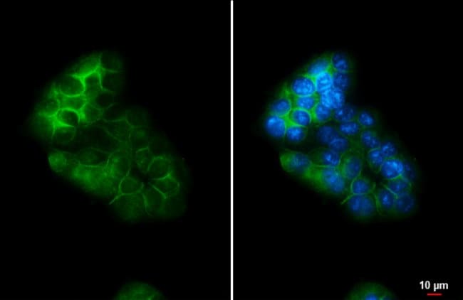 Glypican 1 Polyclonal Antibody