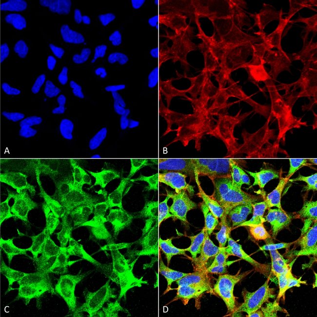 Sulfotyrosine Monoclonal Antibody (7C5)