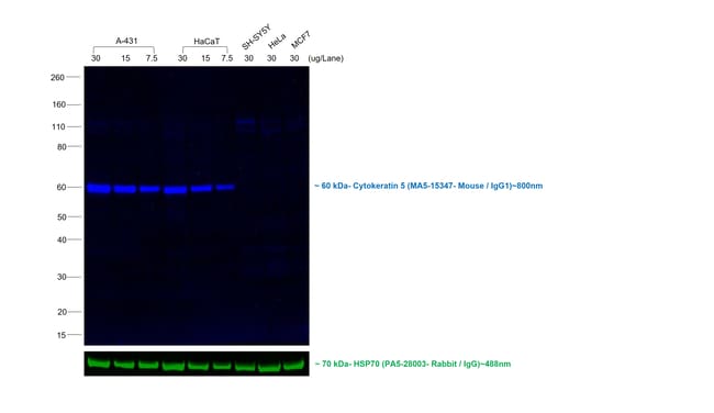 Rabbit anti-Mouse IgG1 Recombinant Secondary Antibody