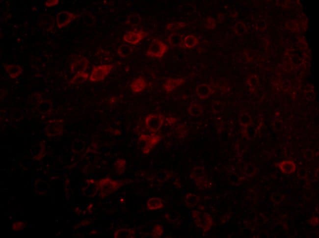 Lass6 Polyclonal Antibody