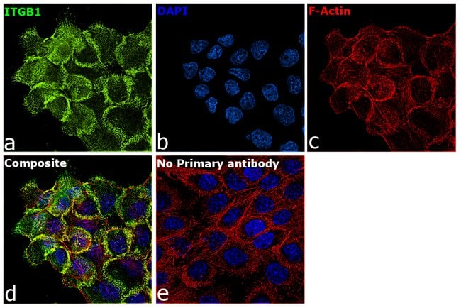 ITGB1 Polyclonal Antibody