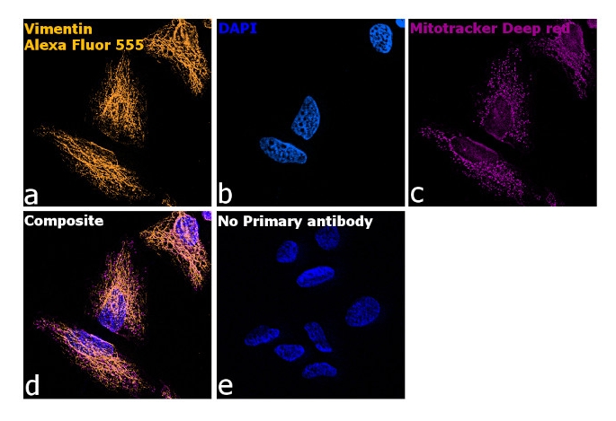 Donkey anti-Chicken IgY (H+L) Highly Cross Adsorbed Secondary Antibody, Alexa Fluor™ 555