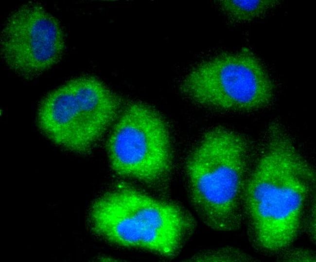 VCAM-1 (CD106) Recombinant Rabbit Monoclonal Antibody (SA05-04)