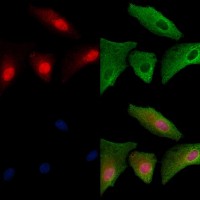 FAM58A Polyclonal Antibody