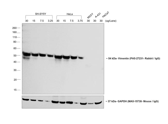 Donkey anti-Rabbit IgG (H+L) Highly Cross-Adsorbed Secondary Antibody, HRP