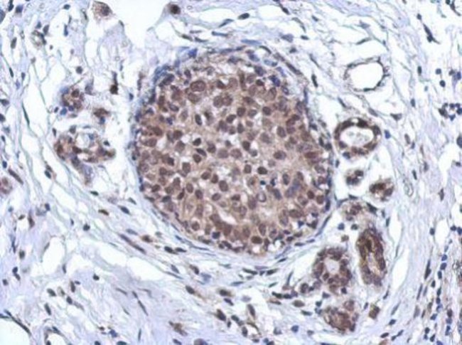 ARS2 Polyclonal Antibody