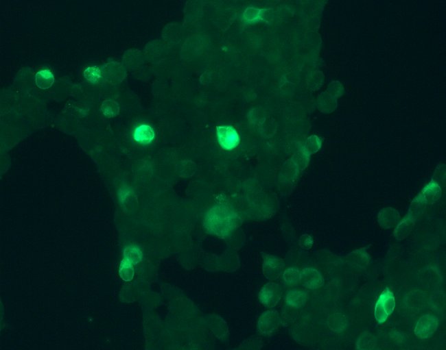 GPR30 Recombinant Rabbit Monoclonal Antibody (20H15L21)