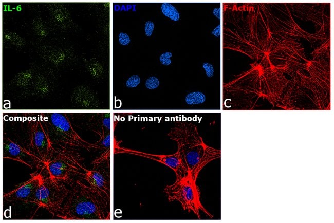IL-6 Recombinant Rabbit Monoclonal Antibody (4H16L21)