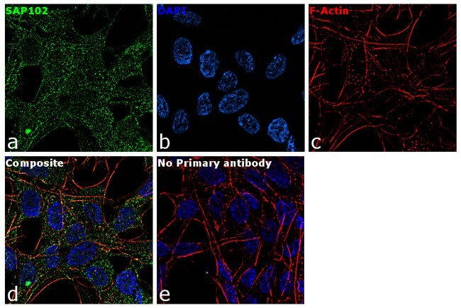 SAP102 Polyclonal Antibody