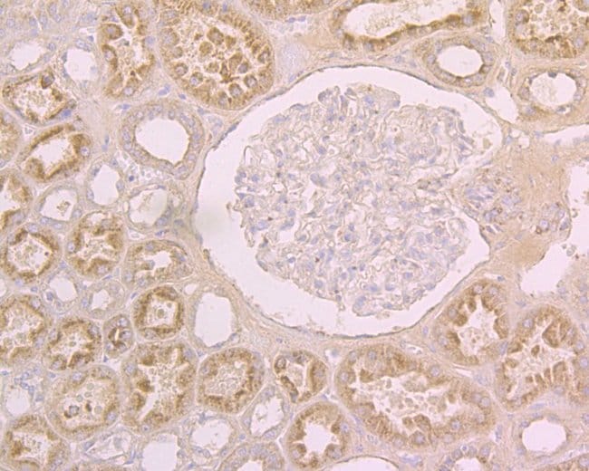 ACE2 Polyclonal Antibody