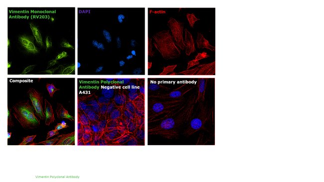 Vimentin Polyclonal Antibody