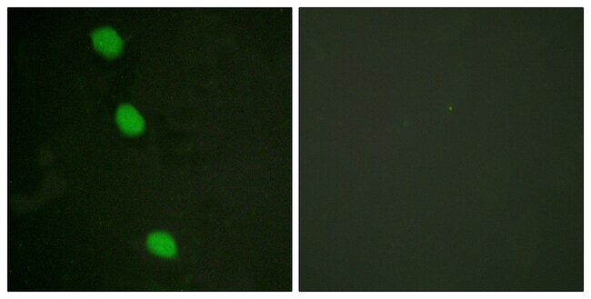 Phospho-CaMKIV (Thr196, Thr200) Polyclonal Antibody
