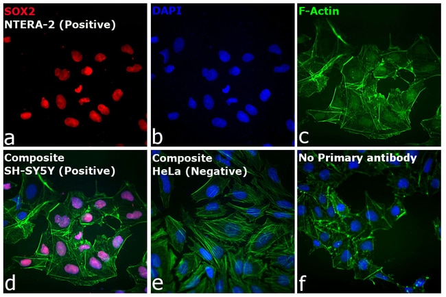 Donkey anti-Rat IgG (H+L) Highly Cross-Adsorbed Secondary Antibody, Alexa Fluor 555
