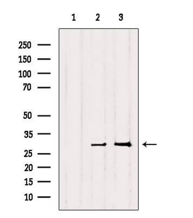 RAB27B Polyclonal Antibody