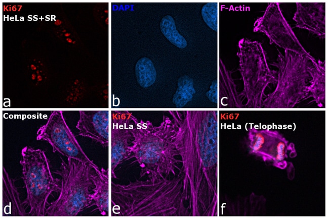 Ki-67 Monoclonal Antibody (SolA15), Alexa Fluor 532, eBioscience