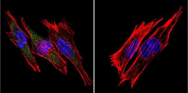 SERCA1 ATPase Monoclonal Antibody (VE121G9)