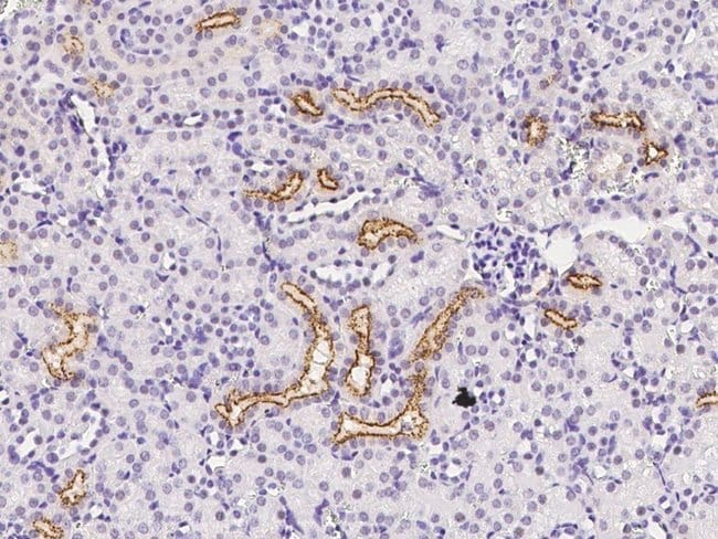 IGFBP2 Polyclonal Antibody