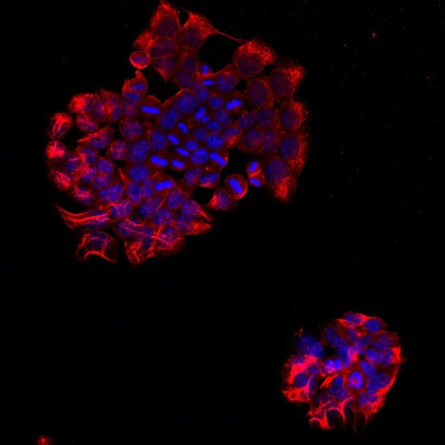 PTPRB Monoclonal Antibody (2-A2)