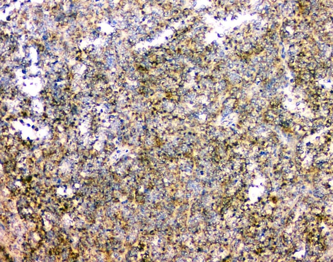 IFN gamma Polyclonal Antibody