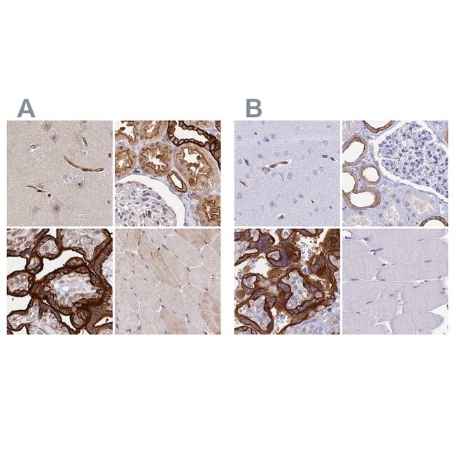 COBLL1 Polyclonal Antibody