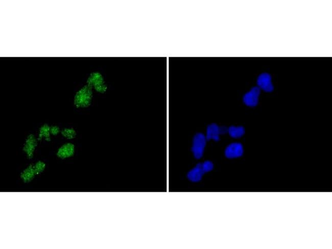 Histone H2A.Z Recombinant Rabbit Monoclonal Antibody (ST46-09)