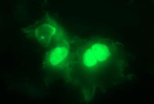 PARVB Monoclonal Antibody (OTI1B9)