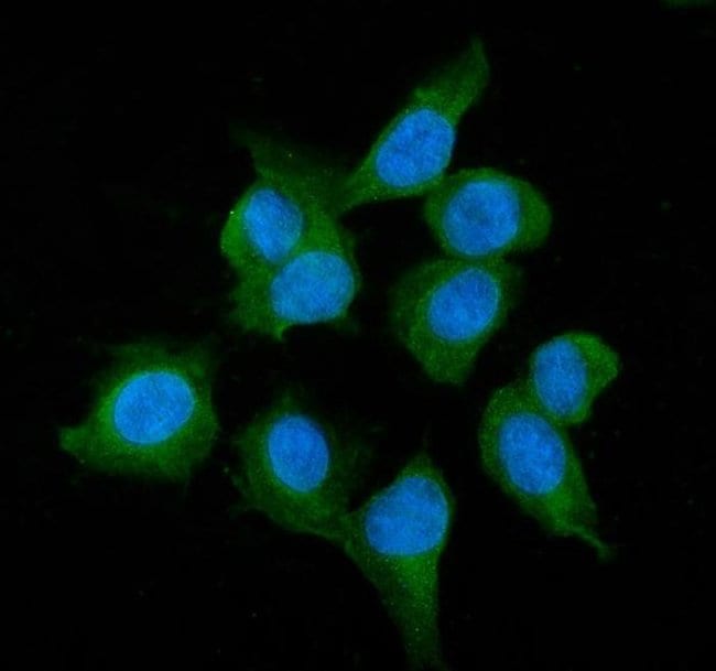 Alcohol Dehydrogenase 1A Polyclonal Antibody