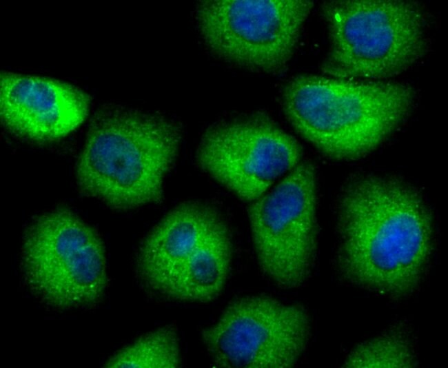 Uteroglobin Recombinant Rabbit Monoclonal Antibody (JU34-03)