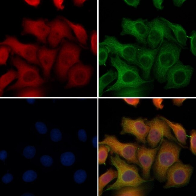 SFTPC Polyclonal Antibody