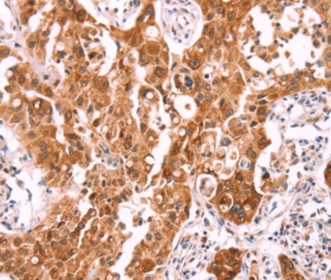 NCEH1 Polyclonal Antibody