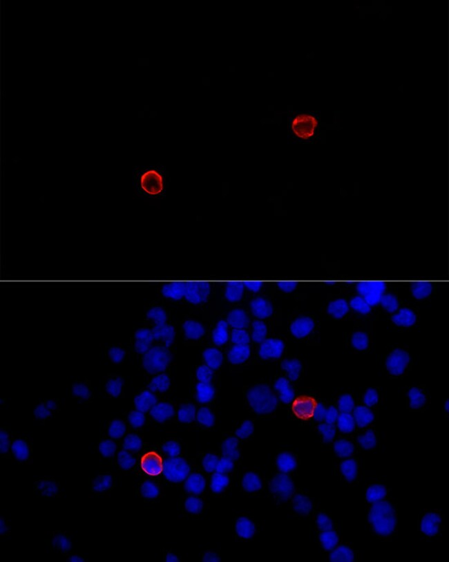 CD299 (DC-SIGN/L) Polyclonal Antibody