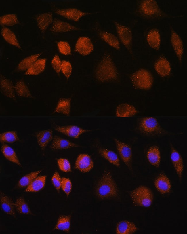 FAM3D Polyclonal Antibody