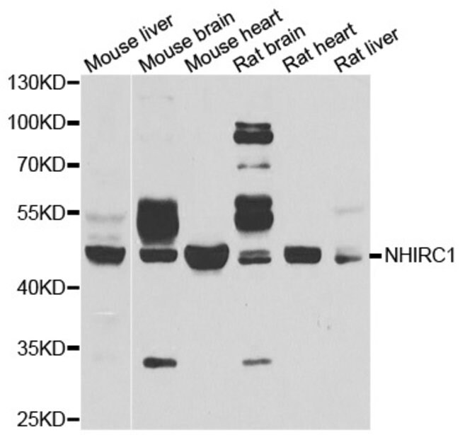 NHLRC1 Polyclonal Antibody