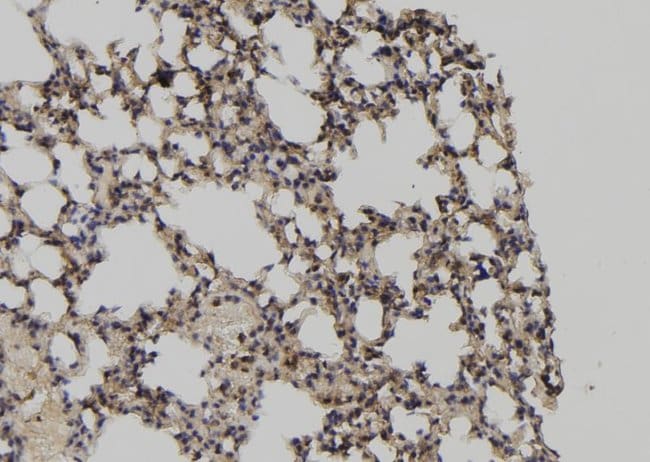 Calpain 3 Polyclonal Antibody