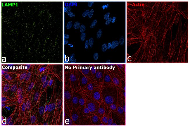 LAMP1 Monoclonal Antibody (LY1C6)