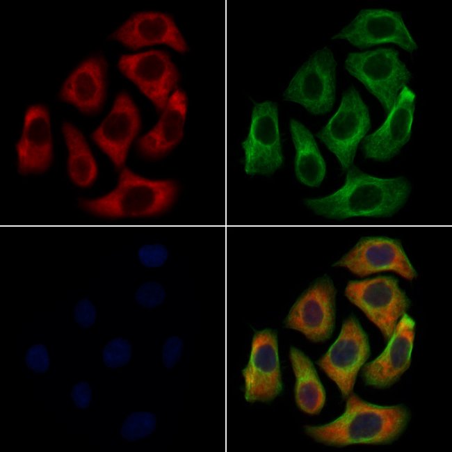 Phospholamban Polyclonal Antibody