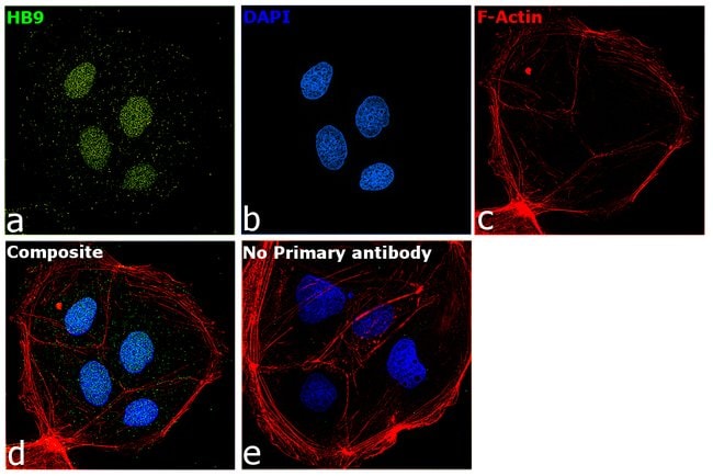 HB9 Polyclonal Antibody