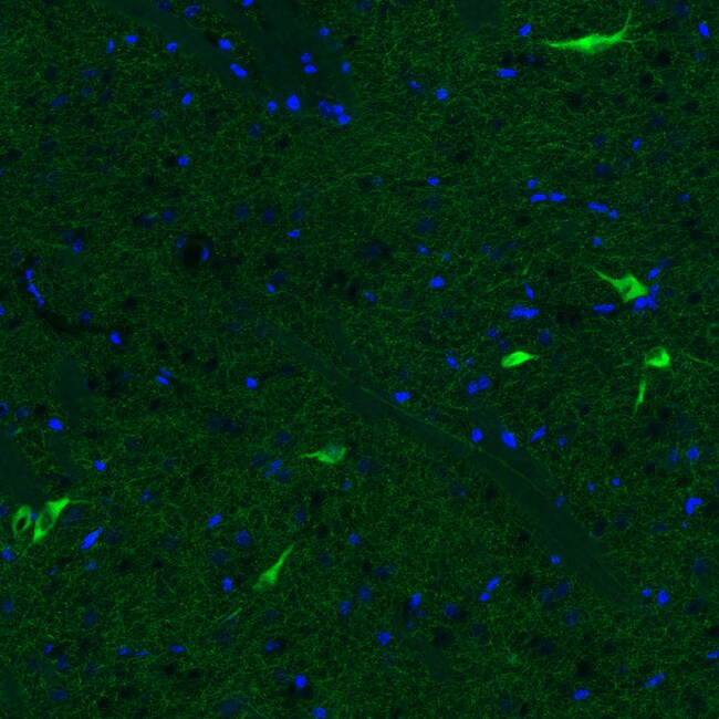 ChAT Monoclonal Antibody (CL3173)