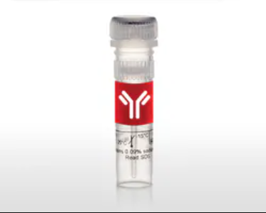 多克隆抗体Vinculin Polyclonal Antibody