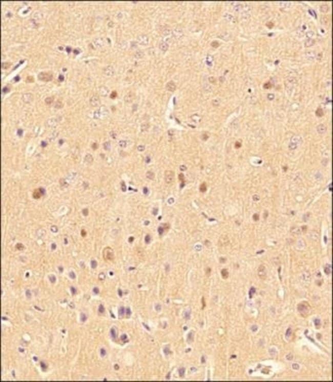 LC3B Polyclonal Antibody