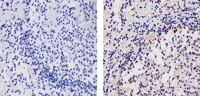 AID Monoclonal Antibody (ZA0...