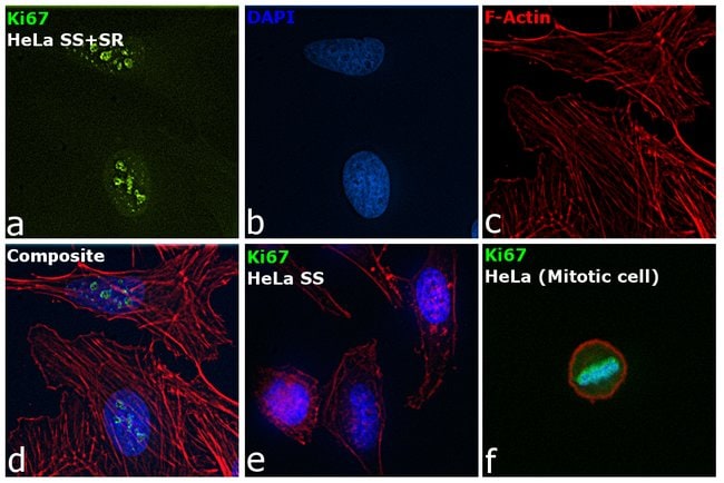 Ki-67 Monoclonal Antibody (SolA15), Alexa Fluor 488, eBioscience