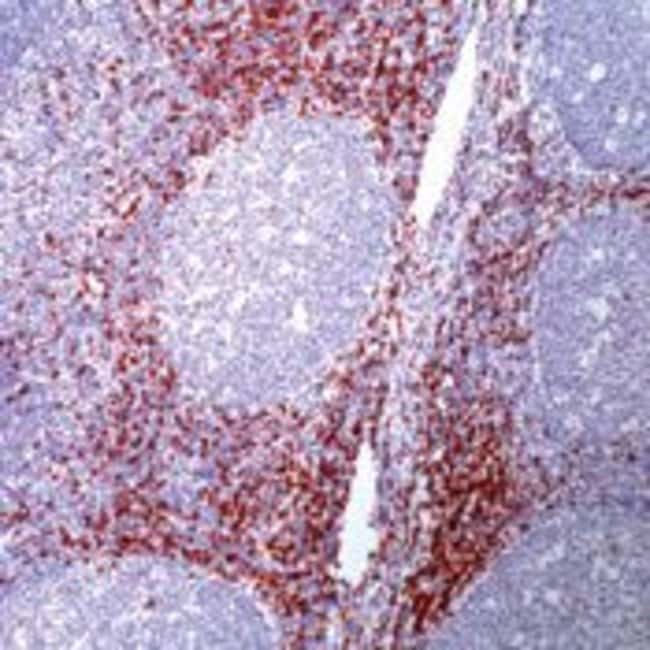 CD8 Monoclonal Antibody (SP16)