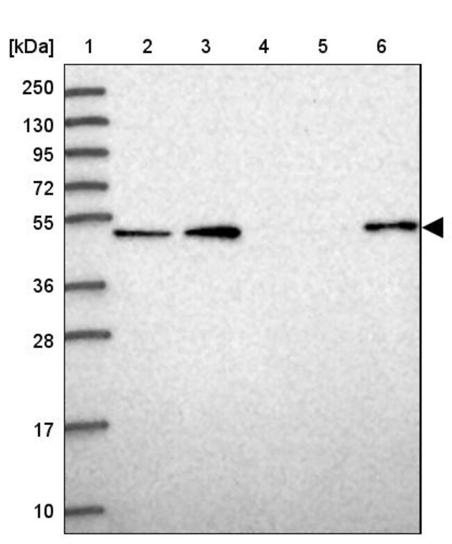 WSCD2 Polyclonal Antibody