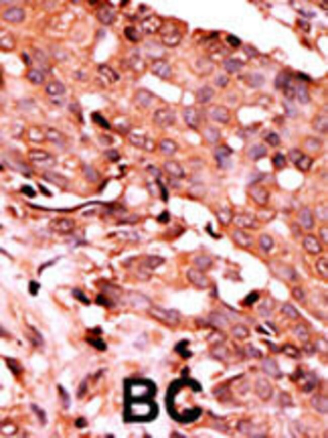 Phospho-Caspase 6 (Ser257) Polyclonal Antibody