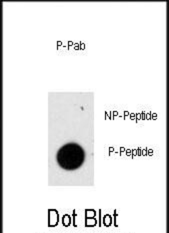 Phospho-GFAP (Ser8) Polyclonal Antibody
