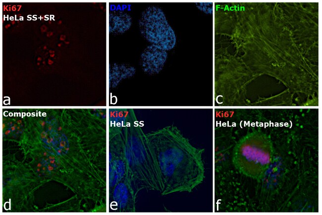 Ki-67 Monoclonal Antibody (SolA15), Alexa Fluor 660, eBioscience