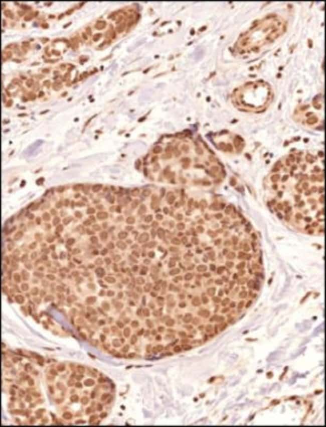PIEZO2 Polyclonal Antibody